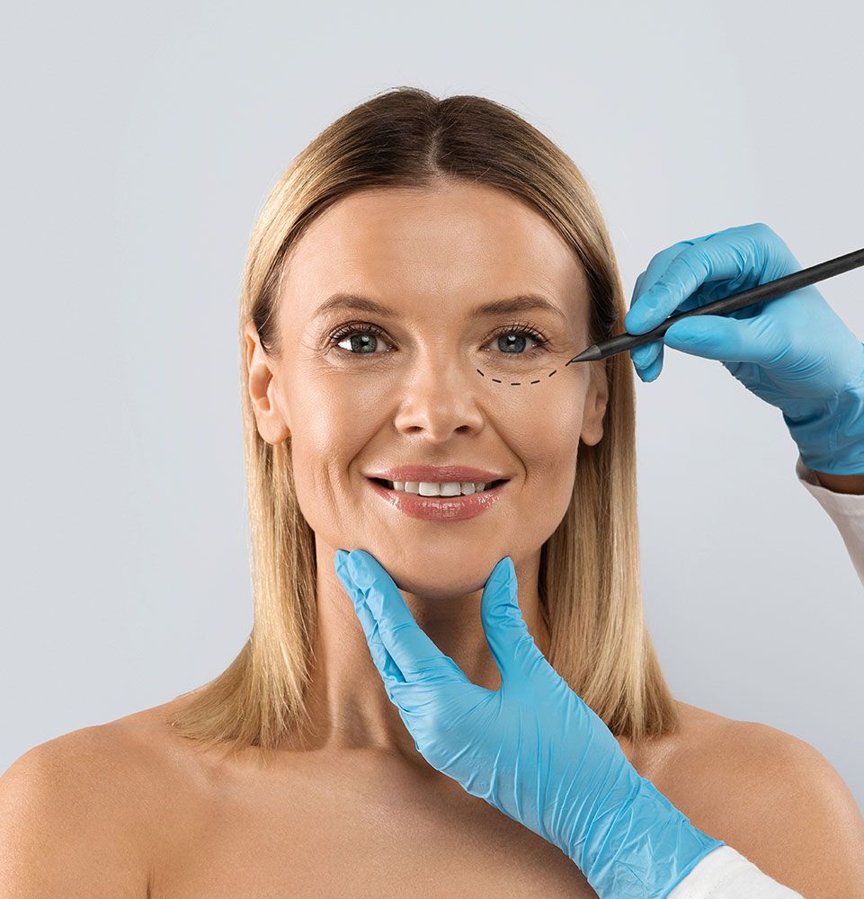 eyelid surgery