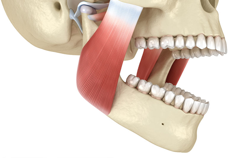 TMJ muscle pain